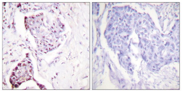 Anti-Ubiquitin antibody produced in rabbit affinity isolated antibody