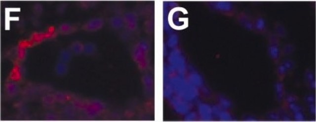 Monoklonaler Anti-Aktin-Antikörper , &#945;-Glattmuskel clone 1A4, ascites fluid