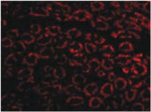 Anti-Nephrin Antibody from rabbit, purified by affinity chromatography