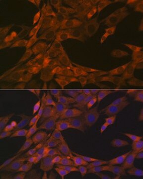 Anti-HE4/WFDC2 antibody produced in rabbit