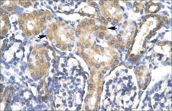 Anti-ACSL1 (AB1) antibody produced in rabbit affinity isolated antibody