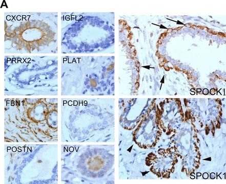 Anti-PLAT antibody produced in rabbit Prestige Antibodies&#174; Powered by Atlas Antibodies, affinity isolated antibody, buffered aqueous glycerol solution