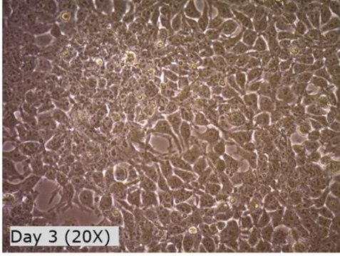 R-Spondin1 expressing 293T Cell Line The R-Spondin1-Expressing 293T cell line produces RSPO1, a critical protein used to establish 3D organoid cultures from stomach, small intestine, colon, pancreas, and liver sources.