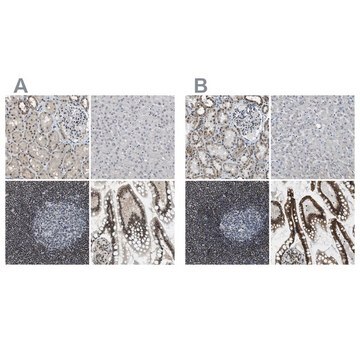 Anti-SP100 antibody produced in rabbit Prestige Antibodies&#174; Powered by Atlas Antibodies, affinity isolated antibody, buffered aqueous glycerol solution