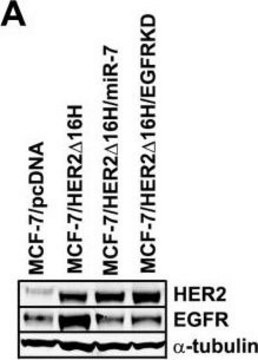 Anti-&#945;-Tubulin-Antikörper, Klon DM1A clone DM1A, Upstate&#174;, from mouse