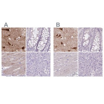 Anti-HOMER1 antibody produced in rabbit Prestige Antibodies&#174; Powered by Atlas Antibodies, affinity isolated antibody, buffered aqueous glycerol solution