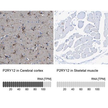 Anti-P2RY12 antibody produced in rabbit Prestige Antibodies&#174; Powered by Atlas Antibodies, affinity isolated antibody, buffered aqueous glycerol solution