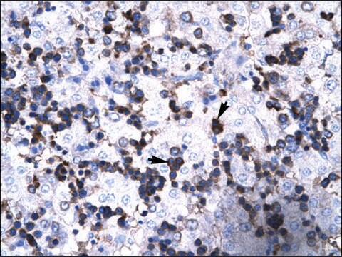 Anti-FOXP3 IgG fraction of antiserum