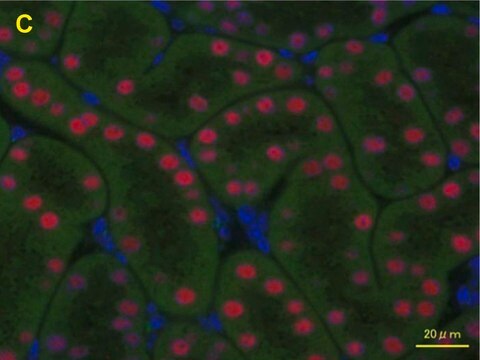 Anti-HNF1B antibody produced in rabbit Prestige Antibodies&#174; Powered by Atlas Antibodies, affinity isolated antibody, buffered aqueous glycerol solution