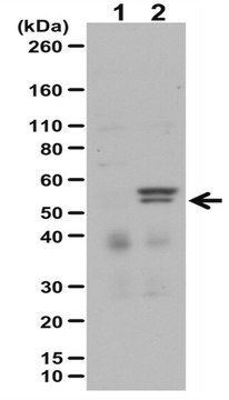 Anti-Phospho-MLKL (Ser358)-Antikörperset from rabbit, purified by affinity chromatography