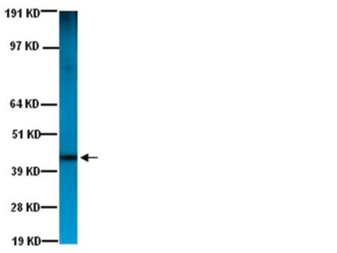 Anti-Actin Antibody, smooth muscle, clone ASM-1 clone ASM-1, Chemicon&#174;, from mouse