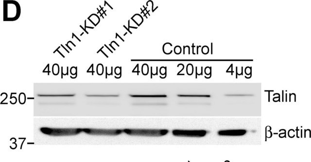 Monoklonaler Anti-Talin-Antikörper in Maus hergestellte Antikörper clone 8d4, ascites fluid