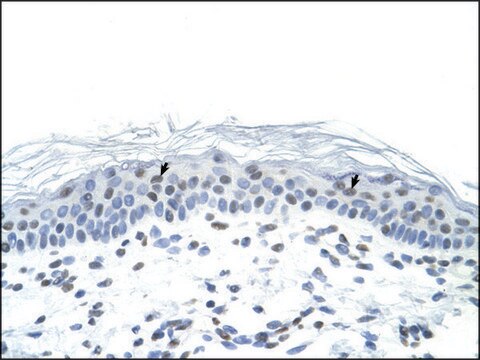 Anti-FOSL1 affinity isolated antibody