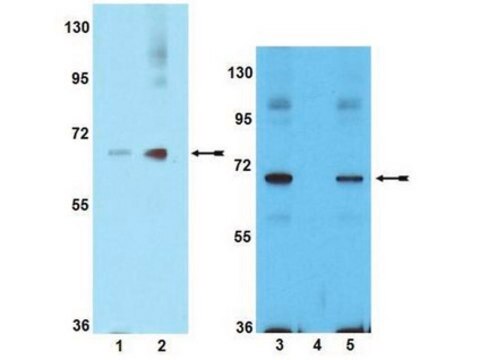 Anti-phospho-PAK1 (Ser199/Ser204) Antibody Upstate&#174;, from rabbit