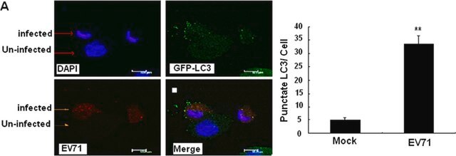 Anti-LC3B antibody produced in rabbit ~1&#160;mg/mL, affinity isolated antibody, buffered aqueous solution