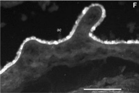 Monoclonal Anti-Cytokeratin Peptide 13 antibody produced in mouse clone KS-1A3, ascites fluid