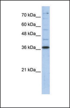 Anti-GAPDH antibody produced in rabbit affinity isolated antibody