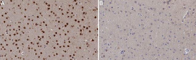 Anti-Tbr2 Antibody from chicken, purified by affinity chromatography