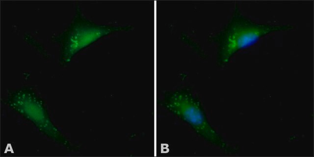 Anti-Cofilin antibody produced in rabbit IgG fraction of antiserum, buffered aqueous solution