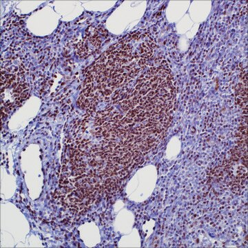 LMO2 (SP51) Rabbit Monoclonal Antibody