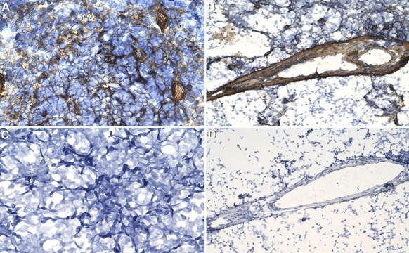 Anti-Complement C4B Antibody, clone 16D2