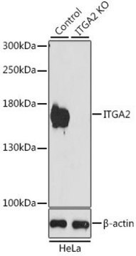 Anti-ITGA2 antibody produced in rabbit