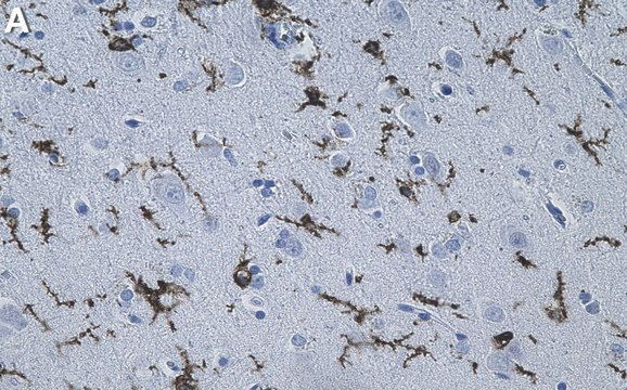 Anti-P2RY12 Antibody, clone 2C12 ZooMAb&#174; Rabbit Monoclonal recombinant, expressed in HEK 293 cells