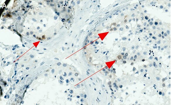 Anti-NY-ESO-1 Antibody, clone 1J11 ZooMAb&#174; Rabbit Monoclonal recombinant, expressed in HEK 293 cells