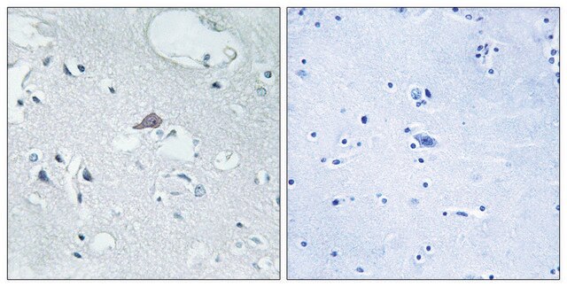 Anti-OPRM1 antibody produced in rabbit affinity isolated antibody