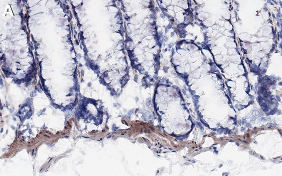 Anti-Heparan Sulfate Antibody, clone T320.11 ZooMAb&#174; Mouse Monoclonal recombinant, expressed in HEK 293 cells