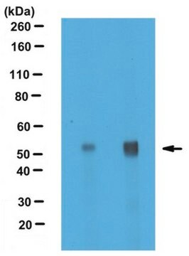 Anti-Alpha-Tubulin-Antikörper, nichttyrosiniert serum, from rabbit