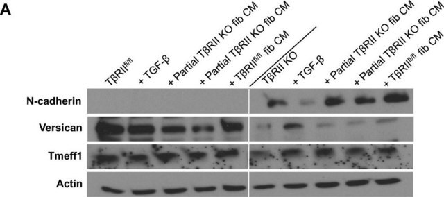 Anti-Versican Antibody, a.a. 1360-1439 of mouse versican Chemicon&#174;, from rabbit