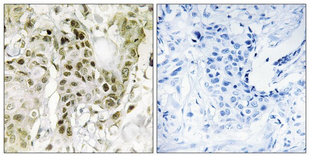 Anti-BCOR antibody produced in rabbit affinity isolated antibody