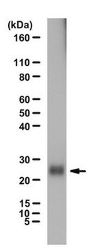 Anti-Ubiquitin-Antikörper from rabbit