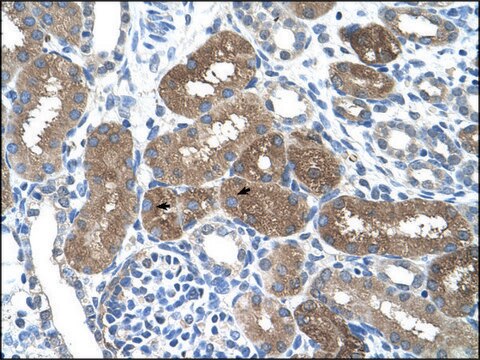 Anti-SOCS1 antibody produced in rabbit IgG fraction of antiserum