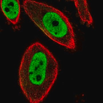 Anti-FOXP3 antibody produced in rabbit Prestige Antibodies&#174; Powered by Atlas Antibodies, affinity isolated antibody