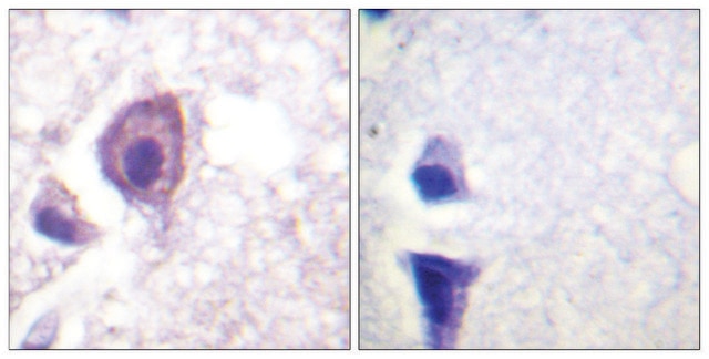 Anti-CD4 antibody produced in rabbit affinity isolated antibody