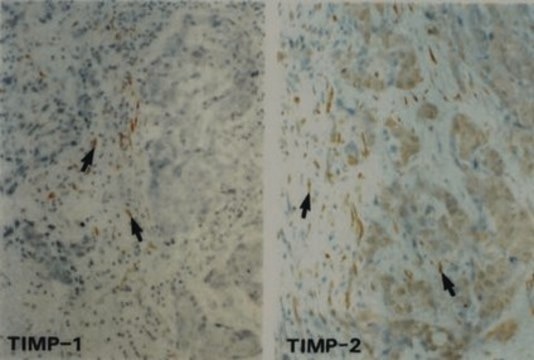 Anti-TIMP-2-Antikörper, Klon&nbsp;67-4H11 clone 67-4H11, Chemicon&#174;, from mouse