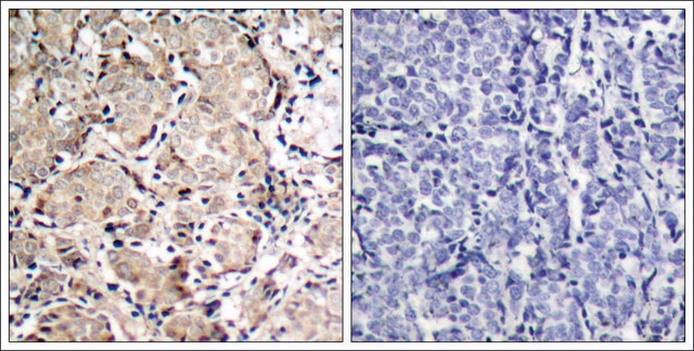 Anti-phospho-FOXO1 (pSer319) antibody produced in rabbit affinity isolated antibody