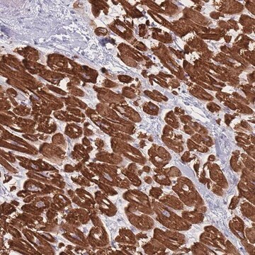 Anti-RNF4 antibody produced in rabbit Prestige Antibodies&#174; Powered by Atlas Antibodies, affinity isolated antibody, buffered aqueous glycerol solution