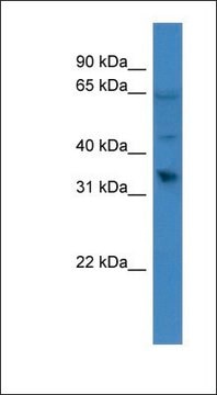 Anti-OR1D2 antibody produced in rabbit affinity isolated antibody