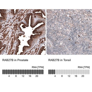 Anti-RAB27B antibody produced in rabbit Prestige Antibodies&#174; Powered by Atlas Antibodies, affinity isolated antibody, buffered aqueous glycerol solution