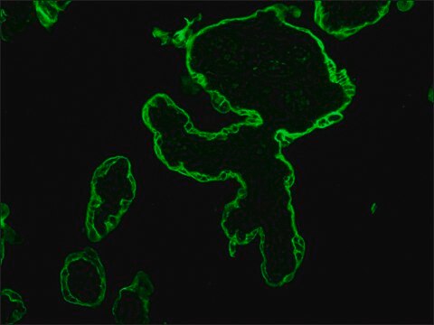 Monoclonal Anti-Cytokeratin Peptide 18 antibody produced in mouse clone CY-90, ascites fluid