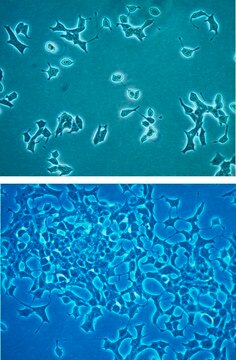 INS-1 832/3 Rat Insulinoma Cell Line INS-1 832/3 rat insulinoma cell line is a useful model for insulin secretion regulation and pancreatic islet beta-cell function studies.