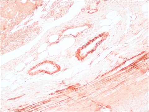 Anti-Mouse IgG (Fc specific)–Peroxidase antibody produced in goat affinity isolated antibody