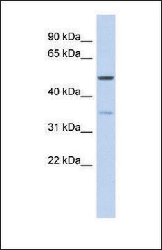 Anti-CETP antibody produced in rabbit affinity isolated antibody