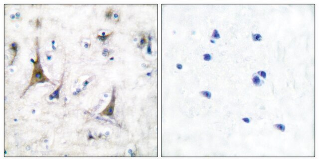 Anti-PGP9.5 antibody produced in rabbit affinity isolated antibody