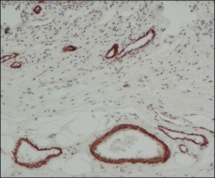 Monoclonal Anti-Actin, &#945;-Smooth Muscle - Peroxidase antibody produced in mouse clone 1A4, purified from hybridoma cell culture