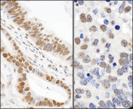 Rabbit anti-Phospho 53BP1 (S25) Antibody, Affinity Purified Powered by Bethyl Laboratories, Inc.