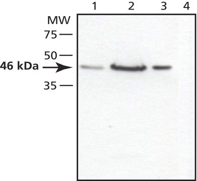 Anti-TSG101 (C-terminal) antibody produced in rabbit ~1.5&#160;mg/mL, affinity isolated antibody, buffered aqueous solution